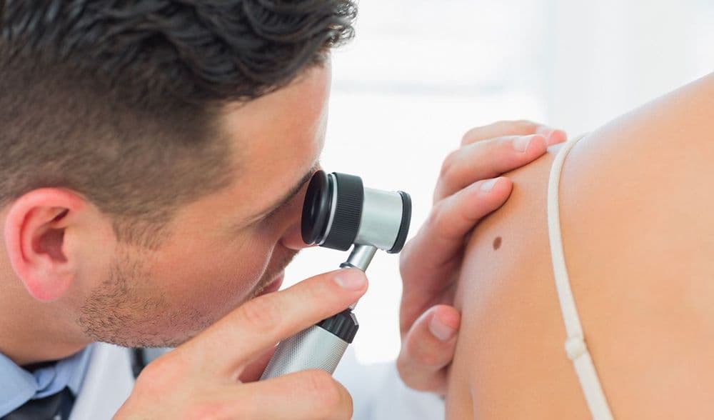 medico visita un possibile melanoma